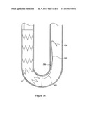 INTRODUCER FOR ENDOVASCULAR IMPLANTS diagram and image