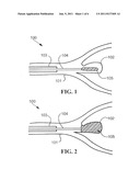 Stent with Expandable Foam diagram and image