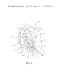 Method and System For Cardiac Valve Delivery diagram and image