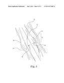 Method and System For Cardiac Valve Delivery diagram and image