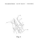 Method and System For Cardiac Valve Delivery diagram and image