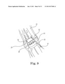 Method and System For Cardiac Valve Delivery diagram and image