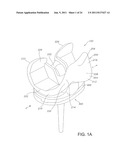 High Performance Knee Prostheses diagram and image