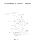 High Performance Knee Prostheses diagram and image