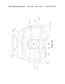 High Performance Knee Prostheses diagram and image