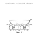 Article Of Footwear With A Sole Structure Having Fluid-Filled Support     Elements diagram and image