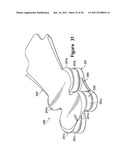 Article Of Footwear With A Sole Structure Having Fluid-Filled Support     Elements diagram and image