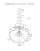 REFILL, WICK ASSEMBLY FOR USE WITH A REFILL, AND METHOD OF RETAINING A     REFILL diagram and image