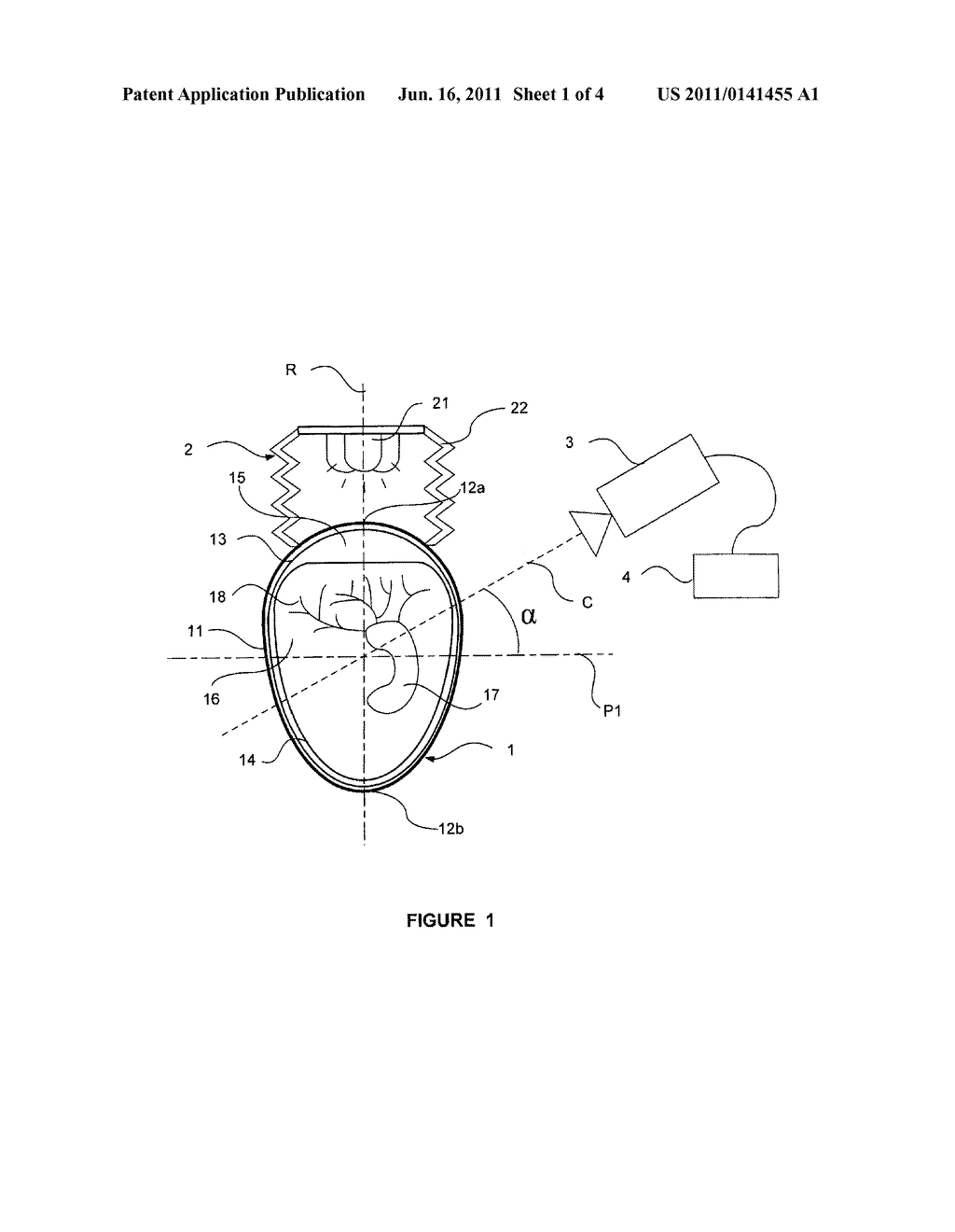 EGG CANDLING METHOD AND CORRESPONDING DEVICE - diagram, schematic, and image 02