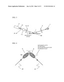 Surface Inspection Method and Surface Inspection Apparatus diagram and image