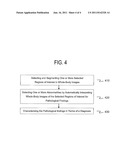 Systems and Methods for Computer Aided Diagnosis and Decision Support in     Whole-Body Imaging diagram and image