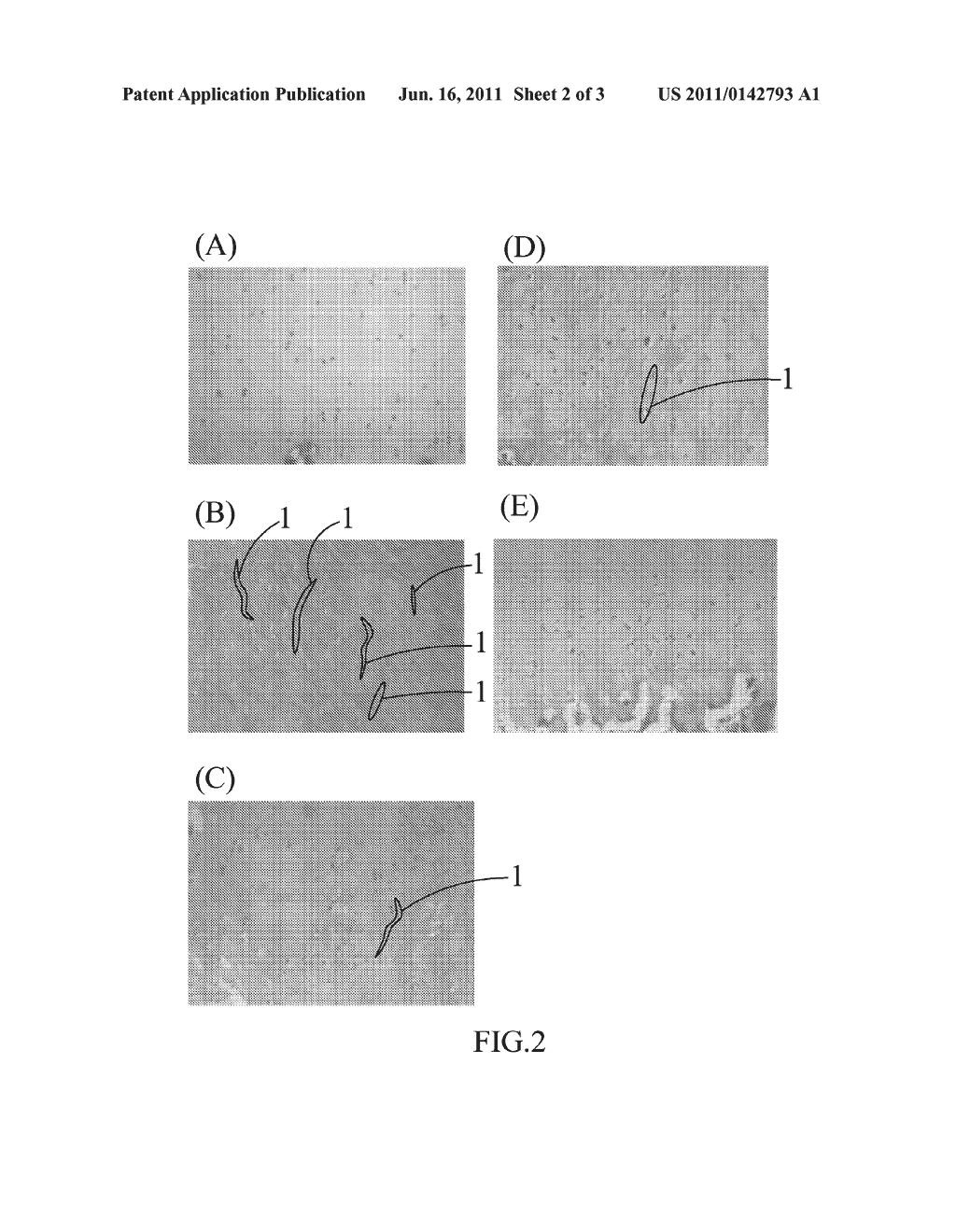 COMPOSITION FOR TREATING ARTICULAR CARTILAGE DEFECT, AND  METHOD OF     MANUFACTURE THEREOF - diagram, schematic, and image 03