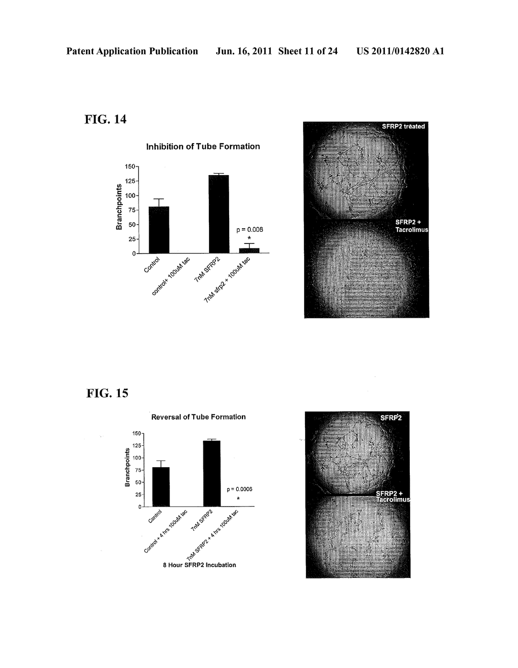 Novel Targets for Regulation of Angiogenesis - diagram, schematic, and image 12