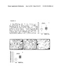 METHOD FOR DIAGNOSING AND TREATING EMPHYSEMA diagram and image