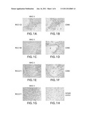 Tumor-associated Peptides Binding Promiscuously  to Human Leukocyte     Antigen (HLA) Class II  Molecules diagram and image