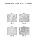 Tumor-associated Peptides Binding Promiscuously  to Human Leukocyte     Antigen (HLA) Class II  Molecules diagram and image