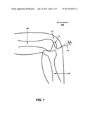 CONTROLLED-RELEASE, INTRA-ARTICULAR THERAPEUTIC AGENT DELIVERY COMPOUND,     AND A METHODOLOGY FOR THE CONTROLLED-RELEASE OF AN INTRA-ARTICULAR     THERAPEUTIC AGENT DELIVERY COMPOUND diagram and image