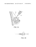 IMPLANTS AND BIODEGRADABLE FIDUCIAL MARKERS diagram and image