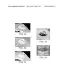 IMPLANTS AND BIODEGRADABLE FIDUCIAL MARKERS diagram and image