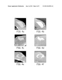 IMPLANTS AND BIODEGRADABLE FIDUCIAL MARKERS diagram and image