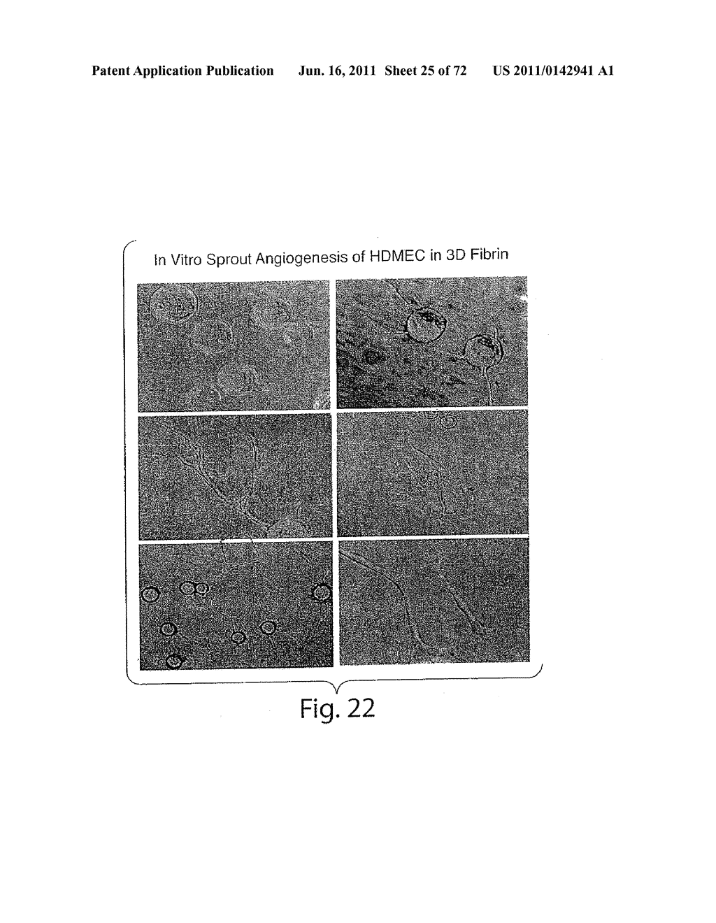 Nanoparticle and Polymer Formulations for Thyroid Hormone Analogs,     Antagonists, and Formulations and Uses Thereof - diagram, schematic, and image 26