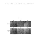 PHARMACEUTICAL COMPOSITION FOR PREVENTING OR TREATING DISEASES ASSOCIATED     WITH BETA-AMYLOID ACCUMULATION CONTAINING MORPHOLIN OR PIPERAZINE BASED     COMPOUNDS HAVING SO3H OR COOH AS ACTIVE INGREDIENT diagram and image