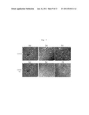 PHARMACEUTICAL COMPOSITION FOR PREVENTING OR TREATING DISEASES ASSOCIATED     WITH BETA-AMYLOID ACCUMULATION CONTAINING MORPHOLIN OR PIPERAZINE BASED     COMPOUNDS HAVING SO3H OR COOH AS ACTIVE INGREDIENT diagram and image