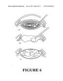 HYDROGEL NANOCOMPOSITES FOR INTRAOCULAR LENS APPLICATONS diagram and image