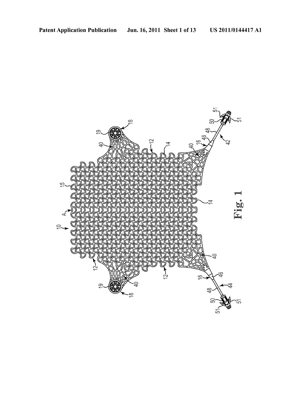 Patterned Implant and Method - diagram, schematic, and image 02