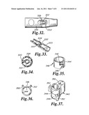 Connector for Mesh Support Insertion diagram and image