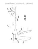 Apparatus for Completing Implantation of Gastric Band diagram and image