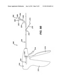 Apparatus for Completing Implantation of Gastric Band diagram and image