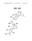 Apparatus for Completing Implantation of Gastric Band diagram and image