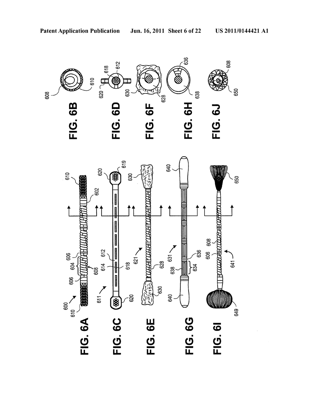 PARTIALLY ERODABLE SYSTEMS FOR TREATMENT OF OBSTRUCTIVE SLEEP APNEA - diagram, schematic, and image 07