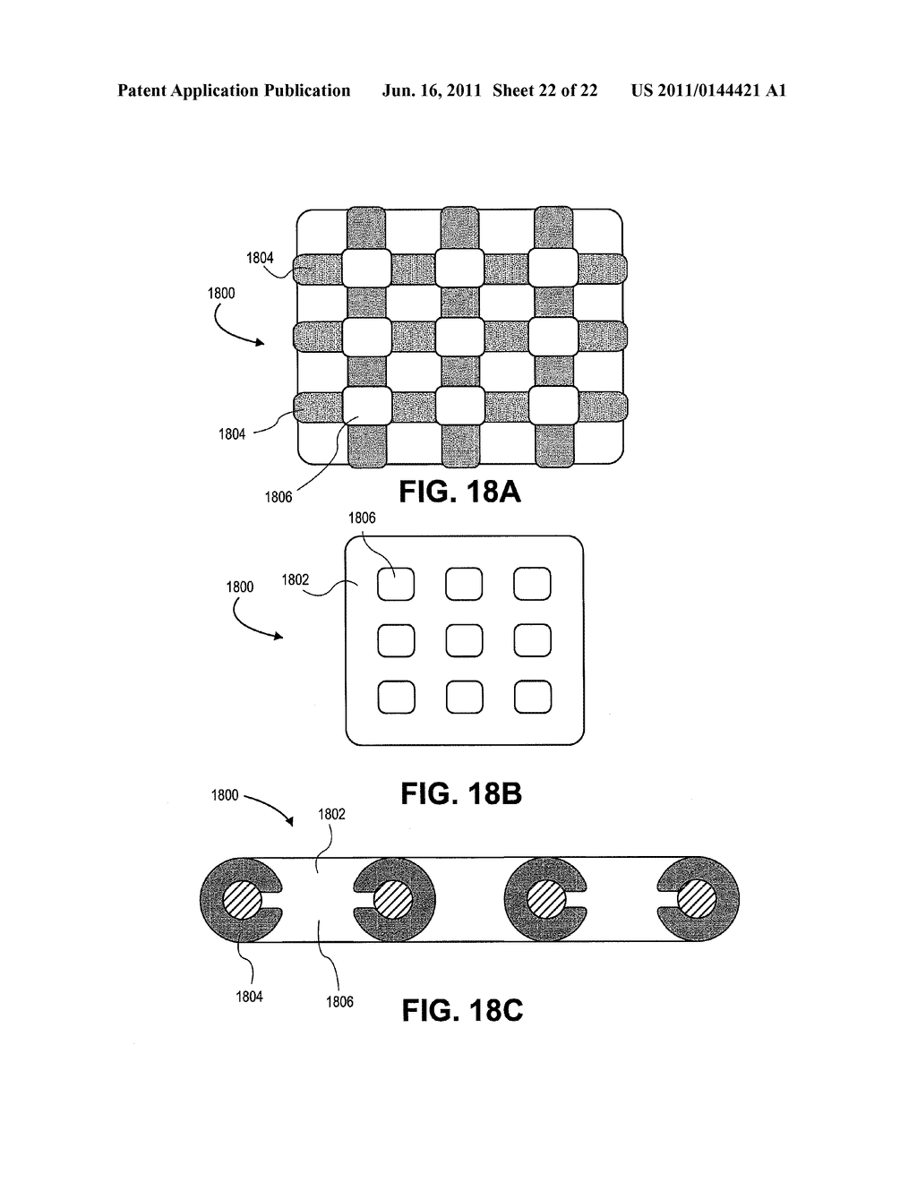 PARTIALLY ERODABLE SYSTEMS FOR TREATMENT OF OBSTRUCTIVE SLEEP APNEA - diagram, schematic, and image 23