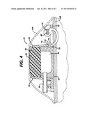 METHOD OF IMPLANTING A FLUID INJECTION PORT diagram and image