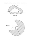 Apparatus and Method for Manipulating or Retracting Tissue and Anatomical     Structure diagram and image