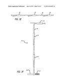 Apparatus and Method for Manipulating or Retracting Tissue and Anatomical     Structure diagram and image