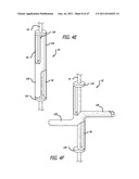 Apparatus and Method for Manipulating or Retracting Tissue and Anatomical     Structure diagram and image