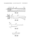 Apparatus and Method for Manipulating or Retracting Tissue and Anatomical     Structure diagram and image