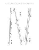 Apparatus and Method for Manipulating or Retracting Tissue and Anatomical     Structure diagram and image