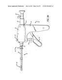 Apparatus and Method for Manipulating or Retracting Tissue and Anatomical     Structure diagram and image