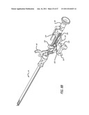 Apparatus and Method for Manipulating or Retracting Tissue and Anatomical     Structure diagram and image