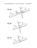 Apparatus and Method for Manipulating or Retracting Tissue and Anatomical     Structure diagram and image