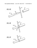 Apparatus and Method for Manipulating or Retracting Tissue and Anatomical     Structure diagram and image