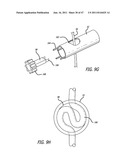 Apparatus and Method for Manipulating or Retracting Tissue and Anatomical     Structure diagram and image