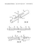 Apparatus and Method for Manipulating or Retracting Tissue and Anatomical     Structure diagram and image