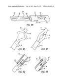 Apparatus and Method for Manipulating or Retracting Tissue and Anatomical     Structure diagram and image