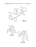 Apparatus and Method for Manipulating or Retracting Tissue and Anatomical     Structure diagram and image