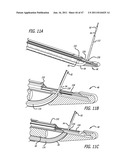 Apparatus and Method for Manipulating or Retracting Tissue and Anatomical     Structure diagram and image